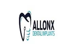 all On X Dental Implants